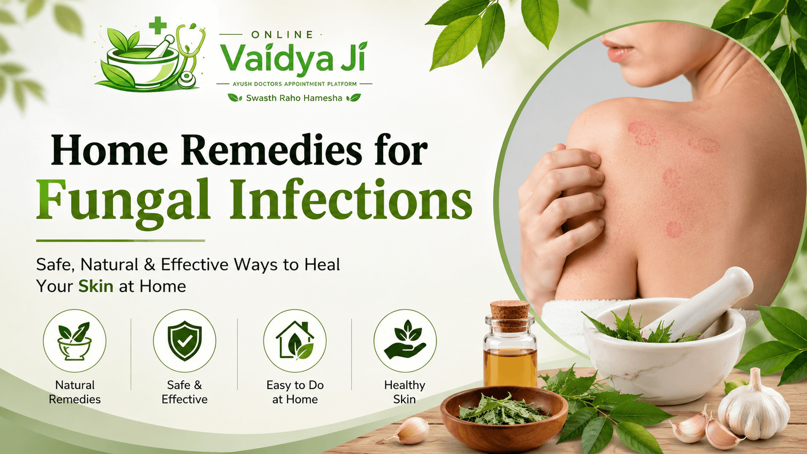 Home Remedies for Fungal Infections: Safe Natural Treatment Guide